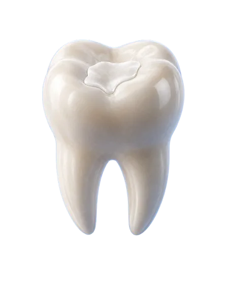 Dental Fillings