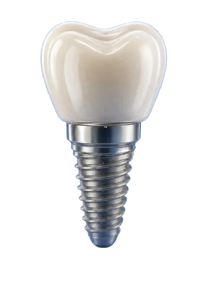 Dental Implants