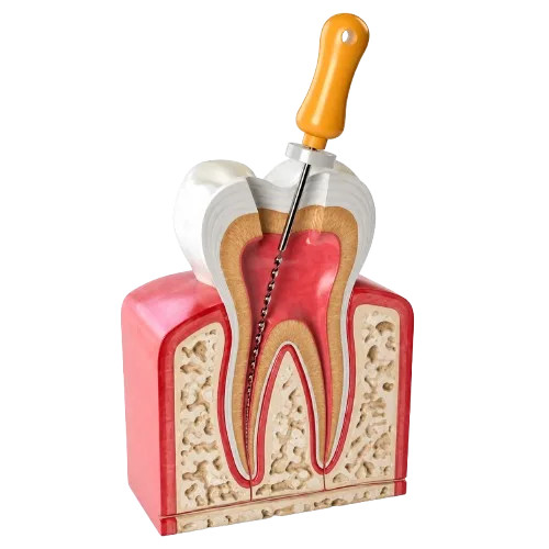 Root canal cross-section